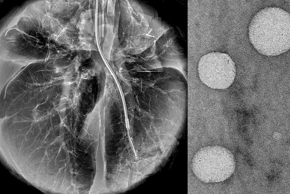 The Vunjak-Novakovic lab is developing nanoparticles to carry therapeutic cargo deep into the lungs and ultrathin catheters to enhance and better control delivery. Images provided by Gordana Vunjak-Novakovic.