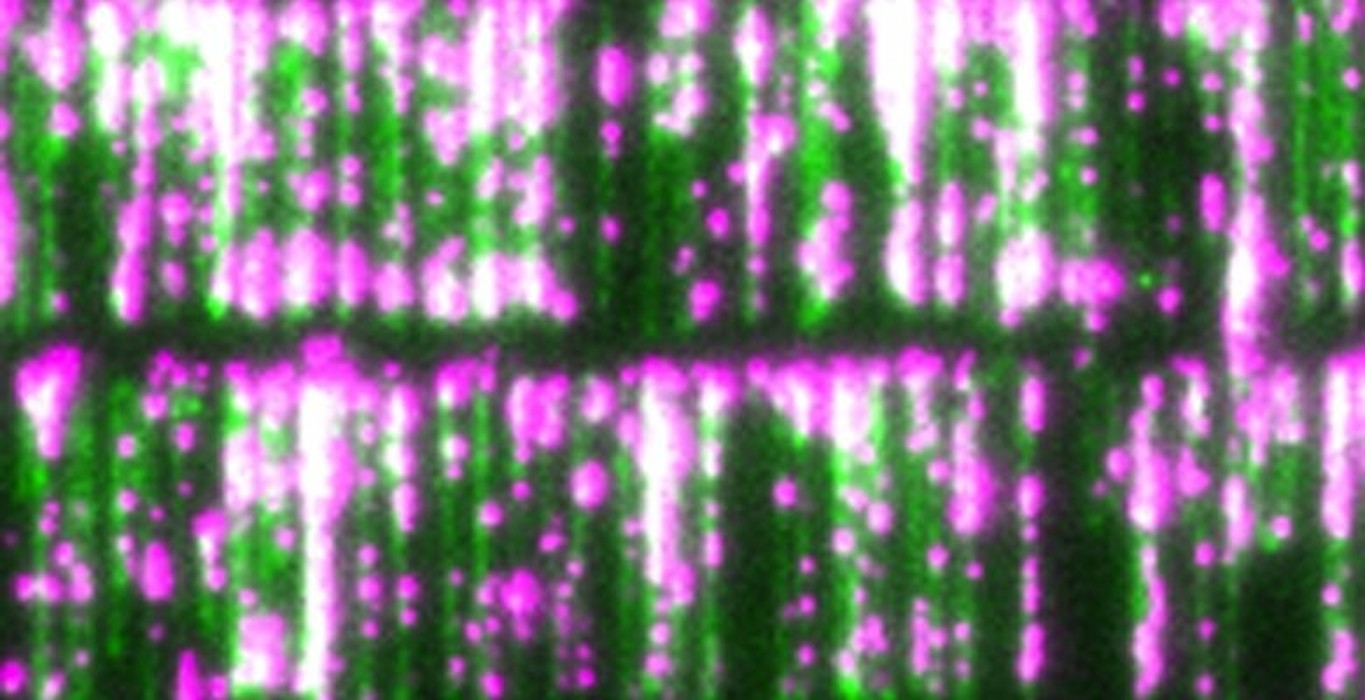 DNA curtains—devised by P&S professor Eric Greene—provide a new way to study DNA-protein interactions. DNA strands are green; proteins are pink. 